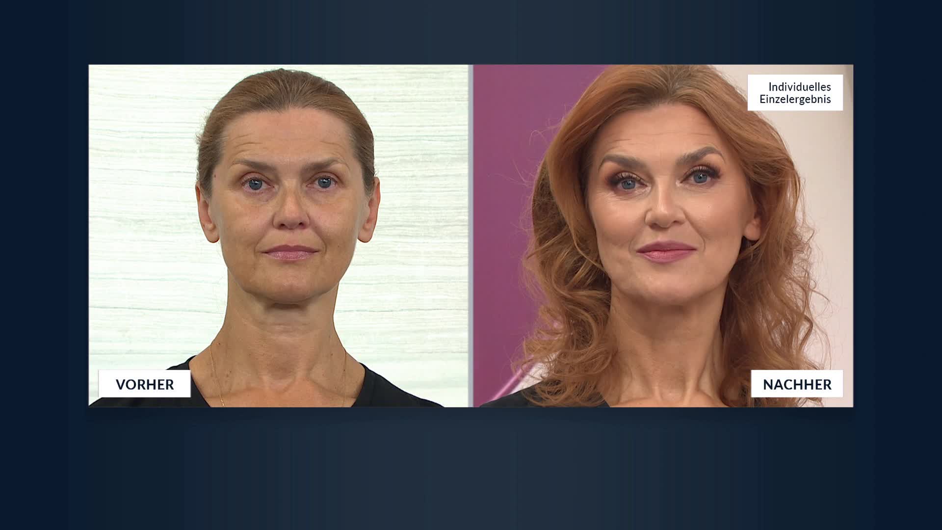 Produktabbildung 2